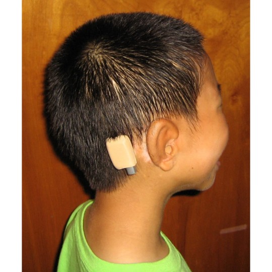 Ear Gear Baha Cordless (Binaural) | Beige