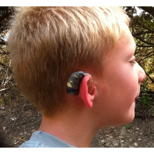 Ear Gear Micro Cordless (Binaural) | Up to 1" Hearing Aids | Orange-Red